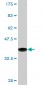 DECR1 Antibody (monoclonal) (M01)