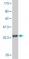 DENR Antibody (monoclonal) (M01)