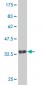 DENR Antibody (monoclonal) (M01)