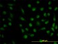 DHFR Antibody (monoclonal) (M01)