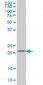 DHFR Antibody (monoclonal) (M01)