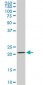 DHFR Antibody (monoclonal) (M01)