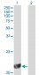 DHFR Antibody (monoclonal) (M01)
