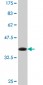 DHX8 Antibody (monoclonal) (M07)