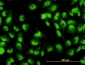 DHX9 Antibody (monoclonal) (M01)