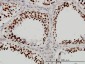 DHX9 Antibody (monoclonal) (M01)