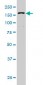 DHX9 Antibody (monoclonal) (M01)