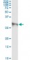 DKK1 Antibody (monoclonal) (M08)