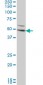 DKK1 Antibody (monoclonal) (M08)