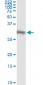 DKK1 Antibody (monoclonal) (M11)