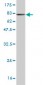 DLD Antibody (monoclonal) (M02)