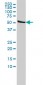 DLD Antibody (monoclonal) (M02)