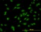 DLX1 Antibody (monoclonal) (M01)