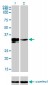 DLX3 Antibody (monoclonal) (M01)