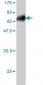 DLX3 Antibody (monoclonal) (M01)