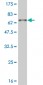 DLX3 Antibody (monoclonal) (M03)