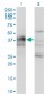 DLX3 Antibody (monoclonal) (M03)