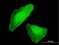 DLX5 Antibody (monoclonal) (M01)