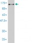 DNAI1 Antibody (monoclonal) (M01)