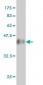 DNAJB2 Antibody (monoclonal) (M03)