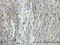 DNM1L Antibody (monoclonal) (M01)