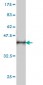 DNM2 Antibody (monoclonal) (M01)