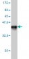 DNTT Antibody (monoclonal) (M01)