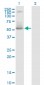DNTT Antibody (monoclonal) (M01)