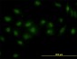 DPF2 Antibody (monoclonal) (M01)