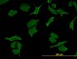 DPYD Antibody (monoclonal) (M01)
