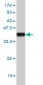 DPYD Antibody (monoclonal) (M01)