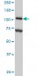 DPYD Antibody (monoclonal) (M01)