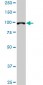 DPYD Antibody (monoclonal) (M01)