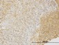 DPYSL3 Antibody (monoclonal) (M01)