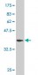 DPYSL3 Antibody (monoclonal) (M01)