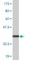 DPYSL5 Antibody (monoclonal) (M02)