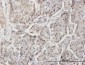 DTX3L Antibody (monoclonal) (M01)