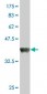 DTX3L Antibody (monoclonal) (M01)