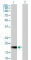 DUSP22 Antibody (monoclonal) (M01)