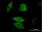 DUSP6 Antibody (monoclonal) (M01)