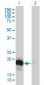 DUT Antibody (monoclonal) (M01)