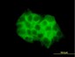 DVL3 Antibody (monoclonal) (M04)