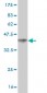 DVL3 Antibody (monoclonal) (M04)