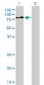 DVL3 Antibody (monoclonal) (M04)