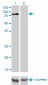 DVL3 Antibody (monoclonal) (M04)