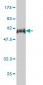 E2F6 Antibody (monoclonal) (M02)