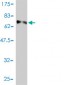 E2F8 Antibody (monoclonal) (M01)