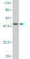 EBAG9 Antibody (monoclonal) (M04)