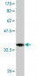 EBF3 Antibody (monoclonal) (M06)