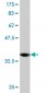 EBF3 Antibody (monoclonal) (M06)